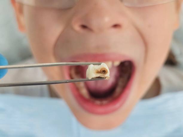 Best Emergency Care for Gum Disease in Mcdade, TX